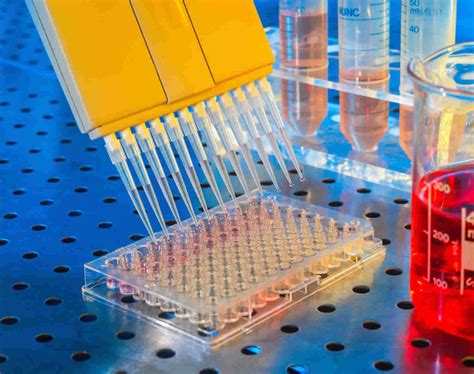 elisa test lab report|how does elisa test work.